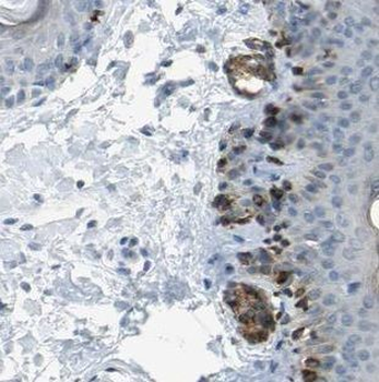 MAD2L1BP Rabbit Polyclonal Antibody