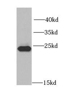 MAD2L2 Rabbit Polyclonal Antibody