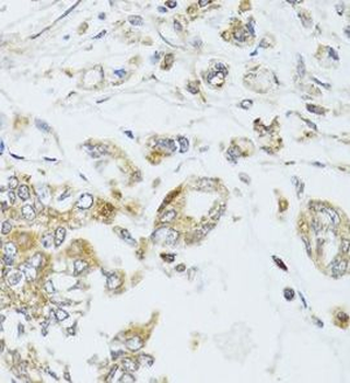 MAD2L2 Rabbit Polyclonal Antibody