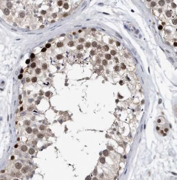 MAGEC2 Rabbit Polyclonal Antibody