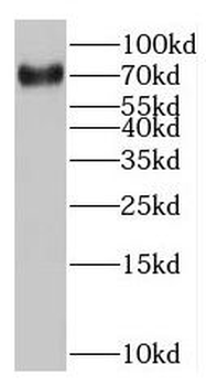 MAGEC3 Antibody