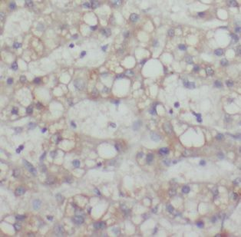 MAGEC3 Antibody