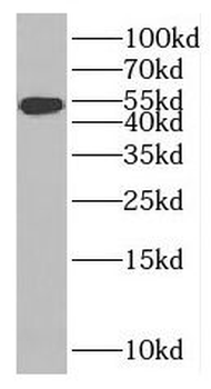 MAGED4 Rabbit Polyclonal Antibody