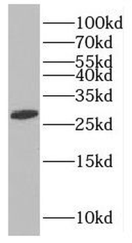 MAGEH1 Rabbit Polyclonal Antibody