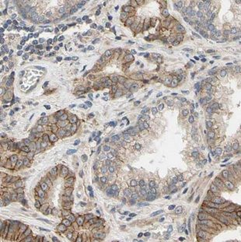 MAGEH1 Rabbit Polyclonal Antibody