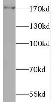 MAP3K4 Rabbit Polyclonal Antibody