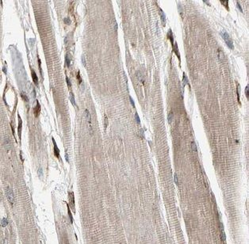 MAP4K4 Rabbit Polyclonal Antibody