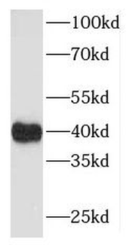 MAP9 Rabbit Polyclonal Antibody