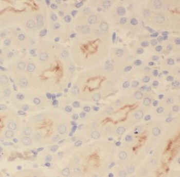 MAPKAP1 Rabbit Polyclonal Antibody