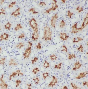 MAPKAP1 Rabbit Polyclonal Antibody