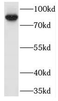 MARK3 Antibody