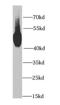 MAT1A Rabbit Polyclonal Antibody