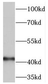 MAT2A Rabbit Polyclonal Antibody