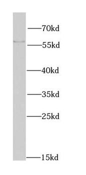 MATK Rabbit Polyclonal Antibody
