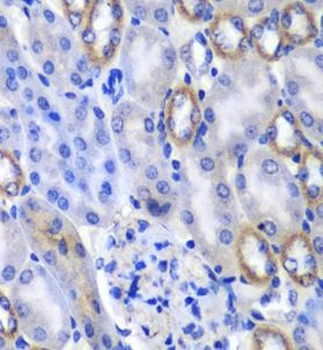 MATK Rabbit Polyclonal Antibody