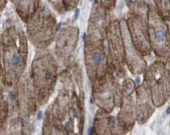 MAVS Rabbit Polyclonal Antibody