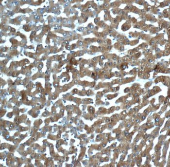 MBL2 Antibody