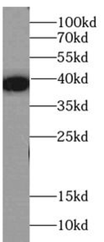 MBP tag Antibody