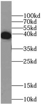 MBP-Tag Antibody