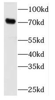 MCCC1 Rabbit Polyclonal Antibody