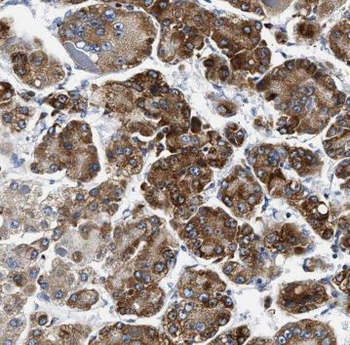 MCCC1 Rabbit Polyclonal Antibody