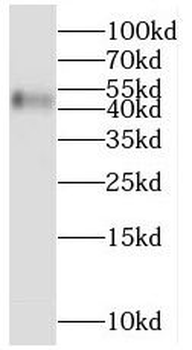 MCHR1 Antibody
