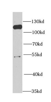 MCM6 Rabbit Polyclonal Antibody