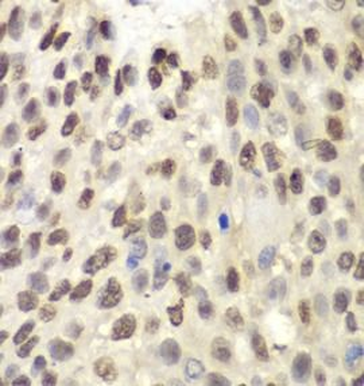 MCM6 Rabbit Polyclonal Antibody