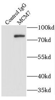 MCM7 Rabbit Polyclonal Antibody