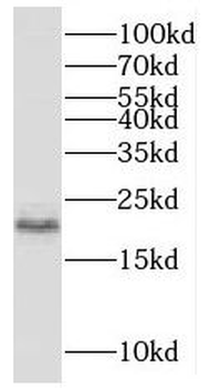 MCTS1 Rabbit Polyclonal Antibody