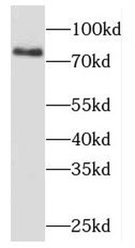 MDM1 Antibody