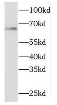 ME1 Rabbit Polyclonal Antibody