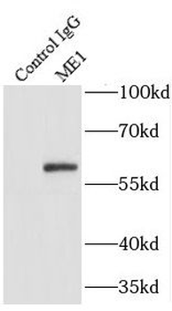 ME1 Rabbit Polyclonal Antibody
