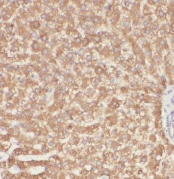 ME1 Rabbit Polyclonal Antibody