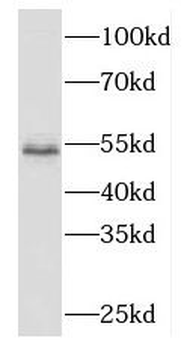 ME2 Rabbit Polyclonal Antibody