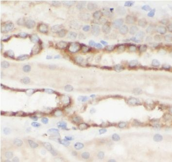ME2 Rabbit Polyclonal Antibody
