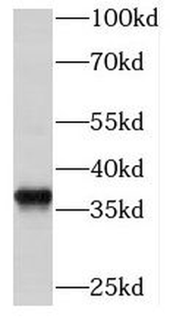 MECR Rabbit Polyclonal Antibody