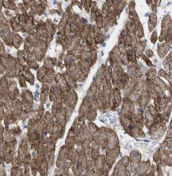 MECR Rabbit Polyclonal Antibody