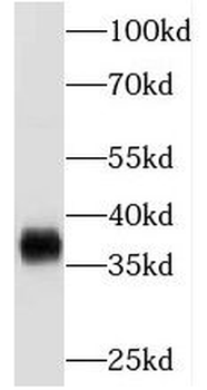 MECR Rabbit Polyclonal Antibody