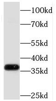 MECR Rabbit Polyclonal Antibody