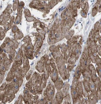 MECR Rabbit Polyclonal Antibody
