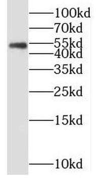 MEF2C Rabbit Polyclonal Antibody