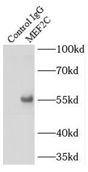 MEF2C Rabbit Polyclonal Antibody