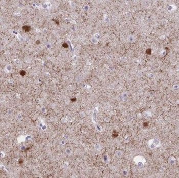 MEF2C Rabbit Polyclonal Antibody