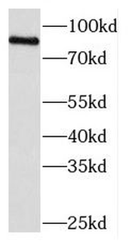 MEFV Rabbit Polyclonal Antibody