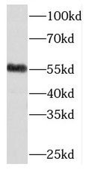 MEIS2 Rabbit Polyclonal Antibody