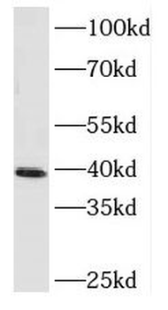 MAP2K3 Rabbit Polyclonal Antibody