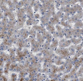 MAP2K3 Rabbit Polyclonal Antibody