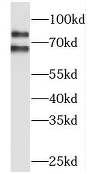 MLPH Rabbit Polyclonal Antibody