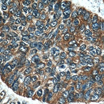 MLPH Rabbit Polyclonal Antibody